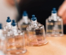 Cupping